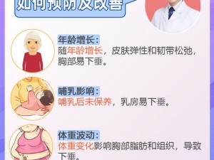 为什么女人的会荡岳？如何通过锻炼改善下垂？大乳荡岳是怎么回事？