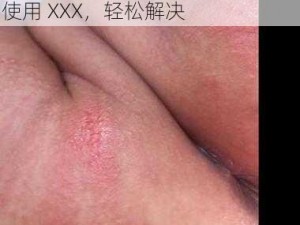 宝宝下面都湿透了还嘴硬疼咋回？使用 XXX，轻松解决