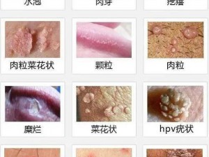 女性三角区长了个硬疙瘩是怎么回事？该如何消除？