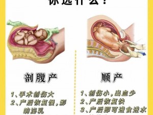 帝王巨腹产子，为何如此？或帝王巨腹产子，怎样做到？或帝王巨腹产子，是何原因？