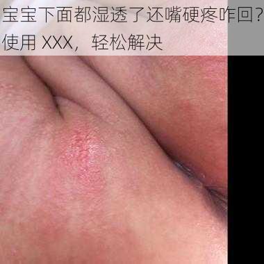 宝宝下面都湿透了还嘴硬疼咋回？使用 XXX，轻松解决