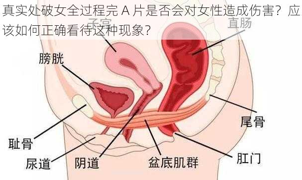 真实处破女全过程完 A 片是否会对女性造成伤害？应该如何正确看待这种现象？