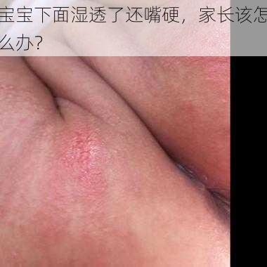 宝宝下面湿透了还嘴硬，家长该怎么办？