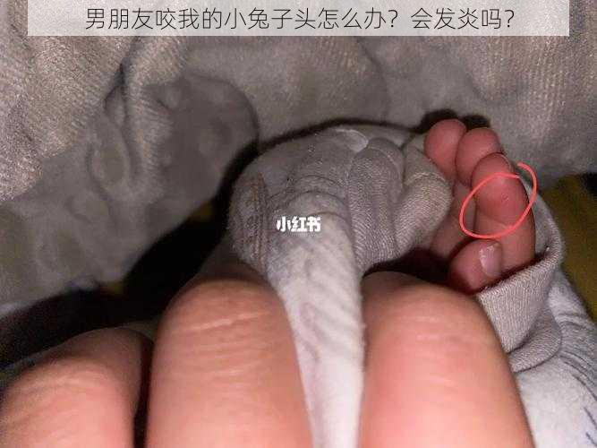 男朋友咬我的小兔子头怎么办？会发炎吗？